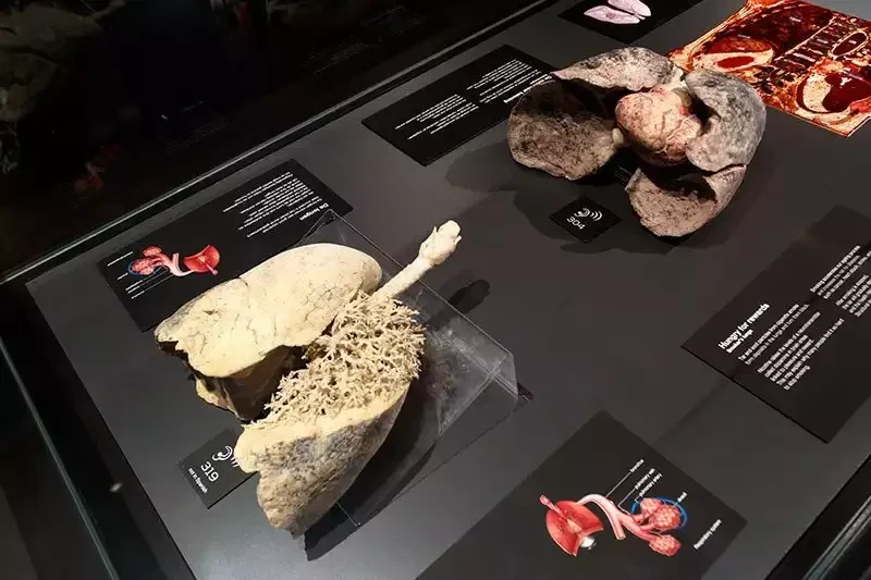 Comparison of healthy pink lungs next to black smoker's lungs at Body Worlds Amsterdam.